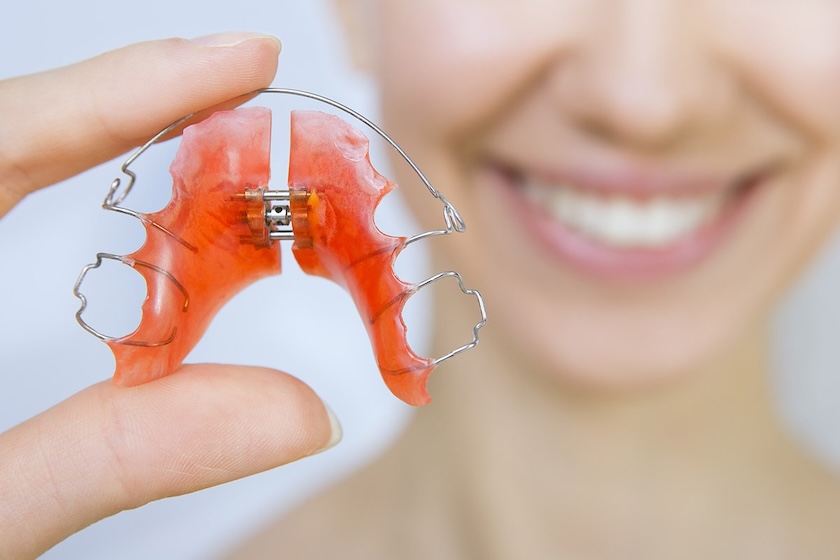 implants